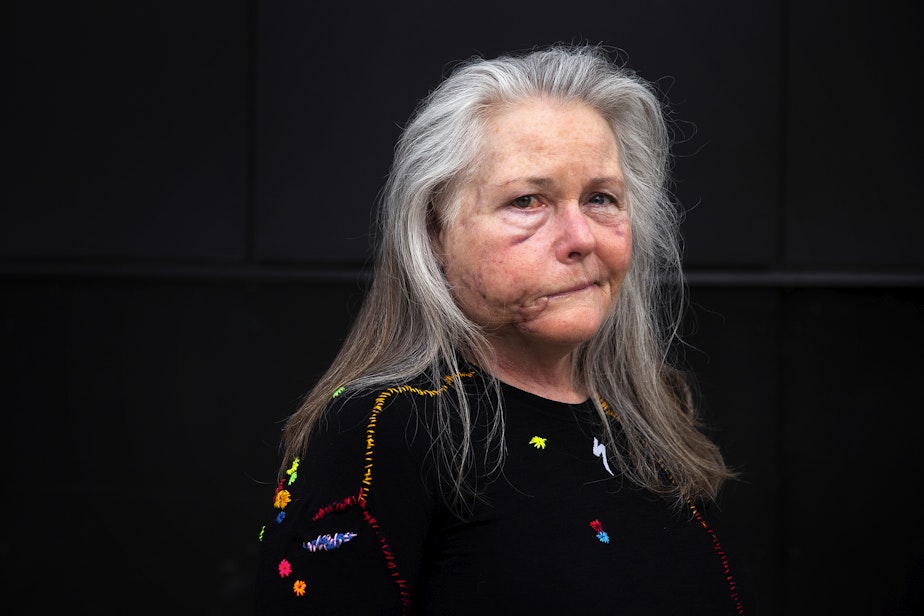 caption: Keri Bergere, a survivor of a recent cougar attack, is portrayed on Wednesday, March 13, 2024, at Log Boom Park in Kenmore. 