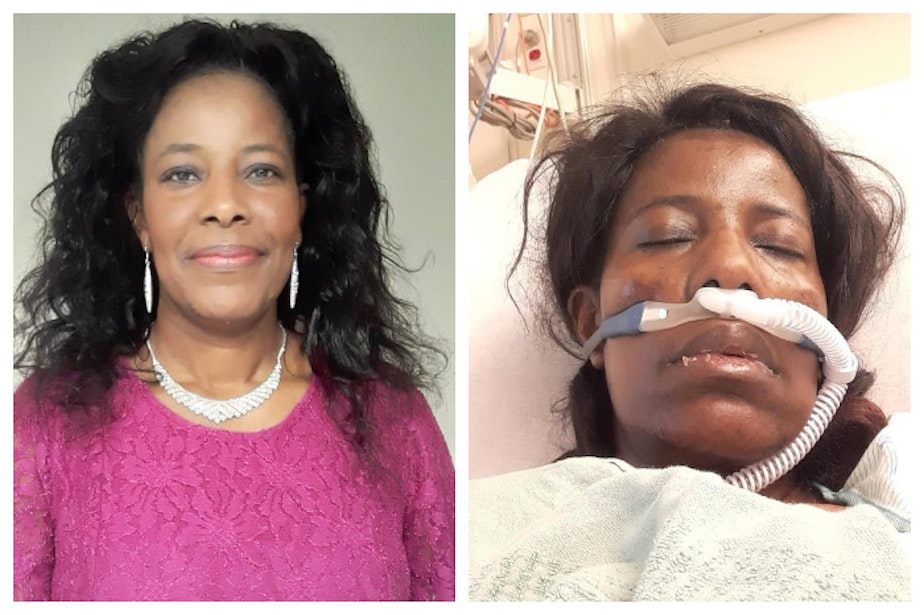 caption: Zipporah Maina, before she got Covid-19 from a wedding in July 2020, and after she was hospitalized.