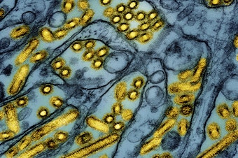 caption: This colorized electron microscope image released by the National Institute of Allergy and Infectious Diseases on March 26, 2024, shows avian influenza A H5N1 virus particles (yellow), grown in Madin-Darby Canine Kidney (MDCK) epithelial cells (blue).