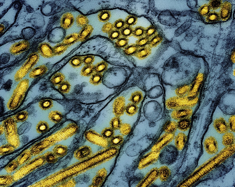 caption: This colorized electron microscope image released by the National Institute of Allergy and Infectious Diseases on March 26, 2024, shows avian influenza A H5N1 virus particles (yellow), grown in Madin-Darby Canine Kidney (MDCK) epithelial cells (blue).